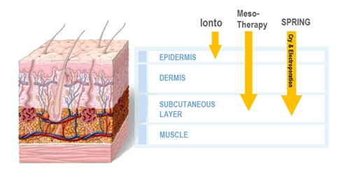 kezelési mélységek összehasonlítása - iontoforézis vs mezoterápia vs elektroporáció 